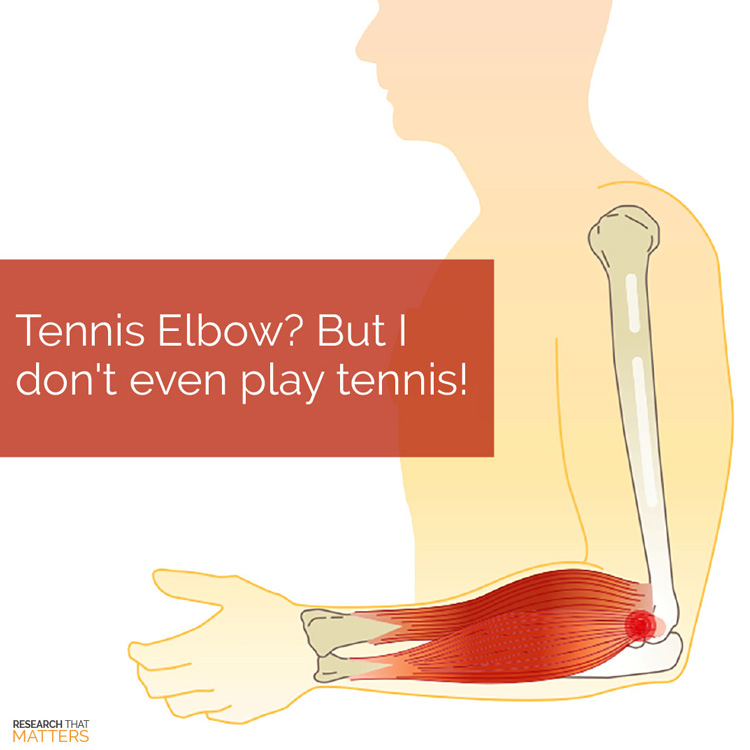 Chiropractic Clarksville MD Tennis Elbow